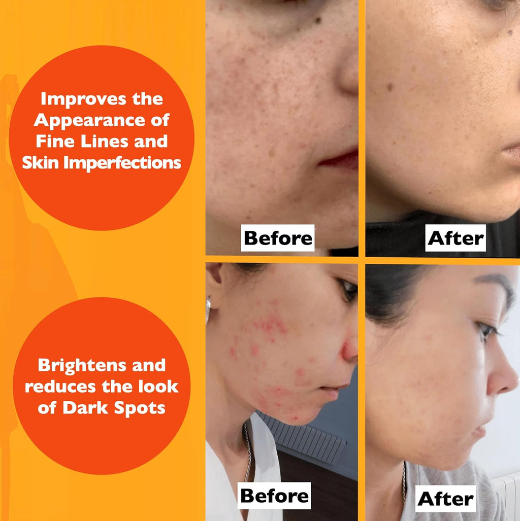 Vitamin C Retinol Hyaluronic Serum Set  Anti Aging Routine