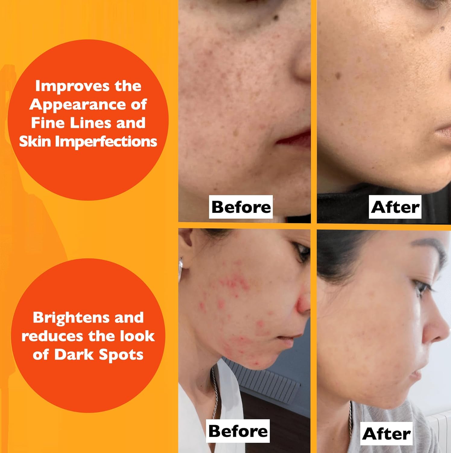 Vitamin C Retinol Hyaluronic Serum Set  Anti Aging Routine