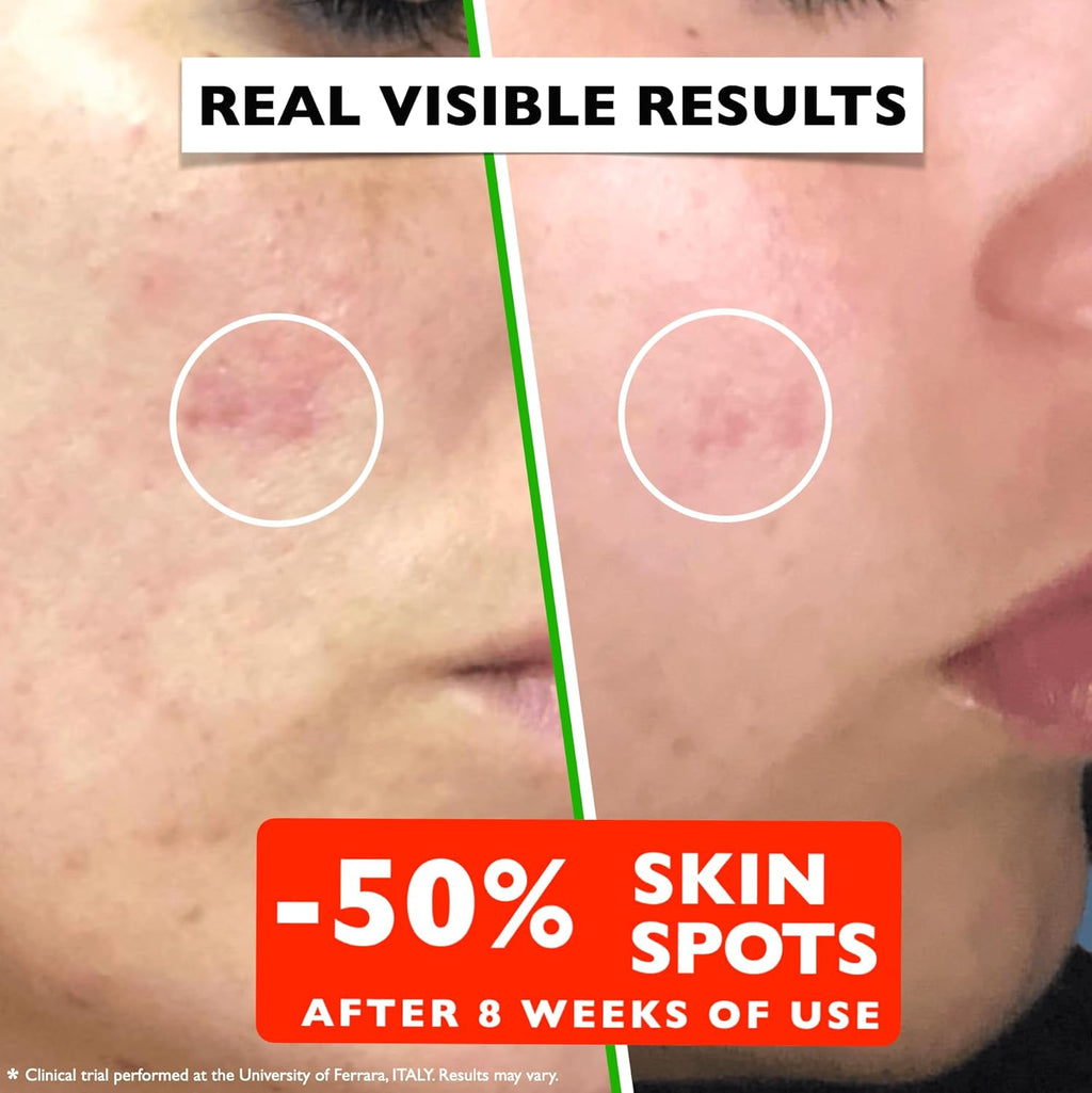 Vitamin C Retinol Hyaluronic Serum Set  Anti Aging Routine