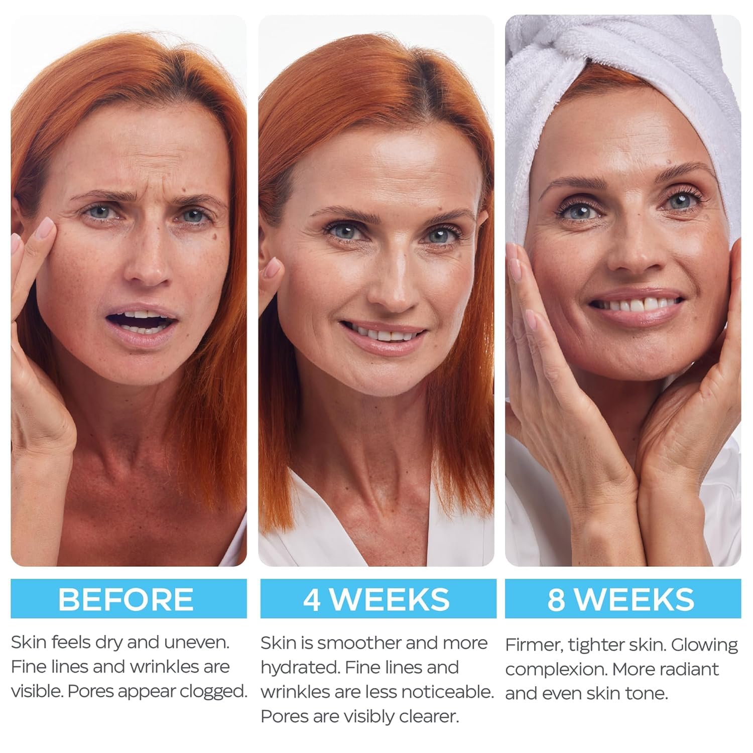 Retinol Face Cream  Anti Aging Moisturizer with Hyaluronic