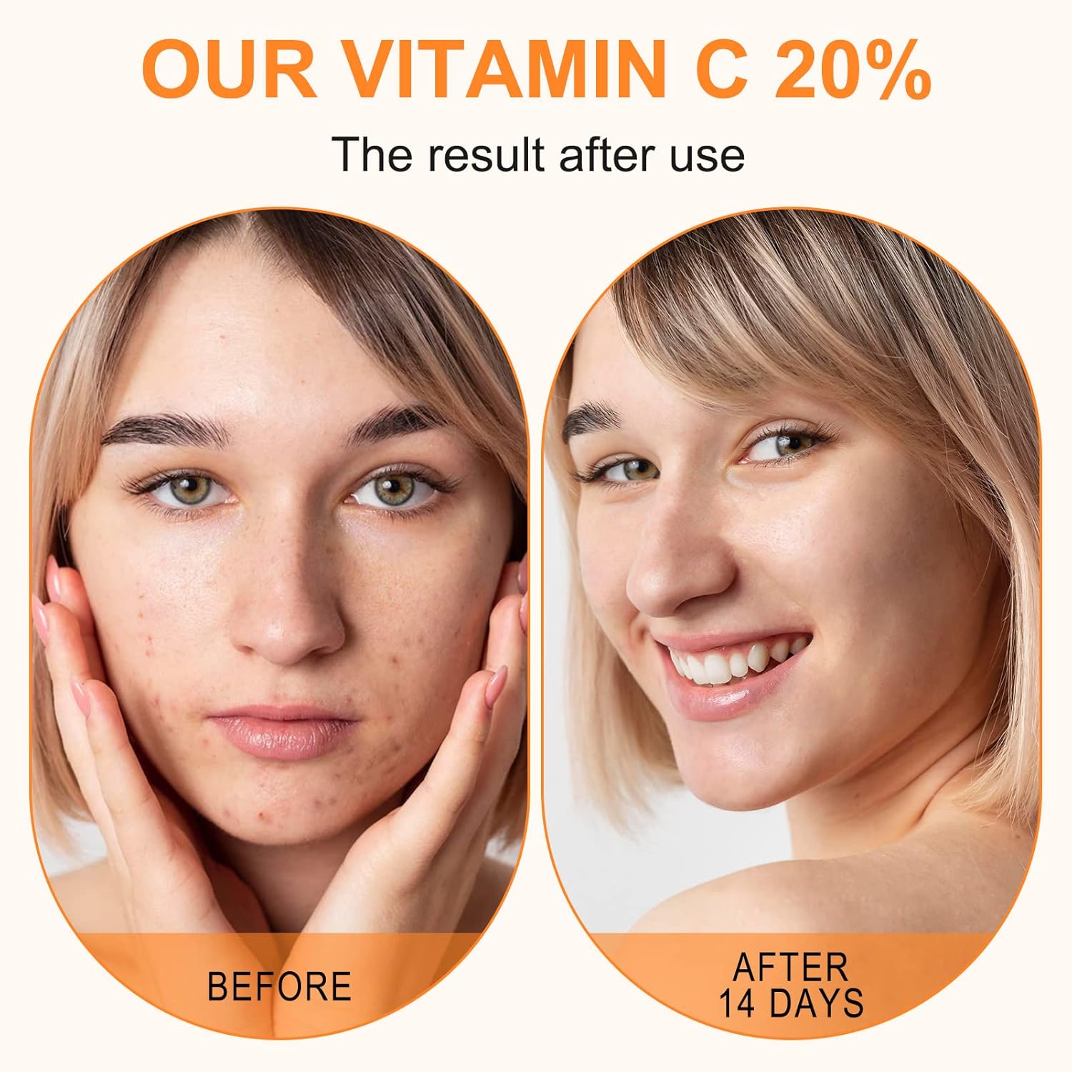 Vitamin C Serum 20%  Brightening Anti Aging Face Serum