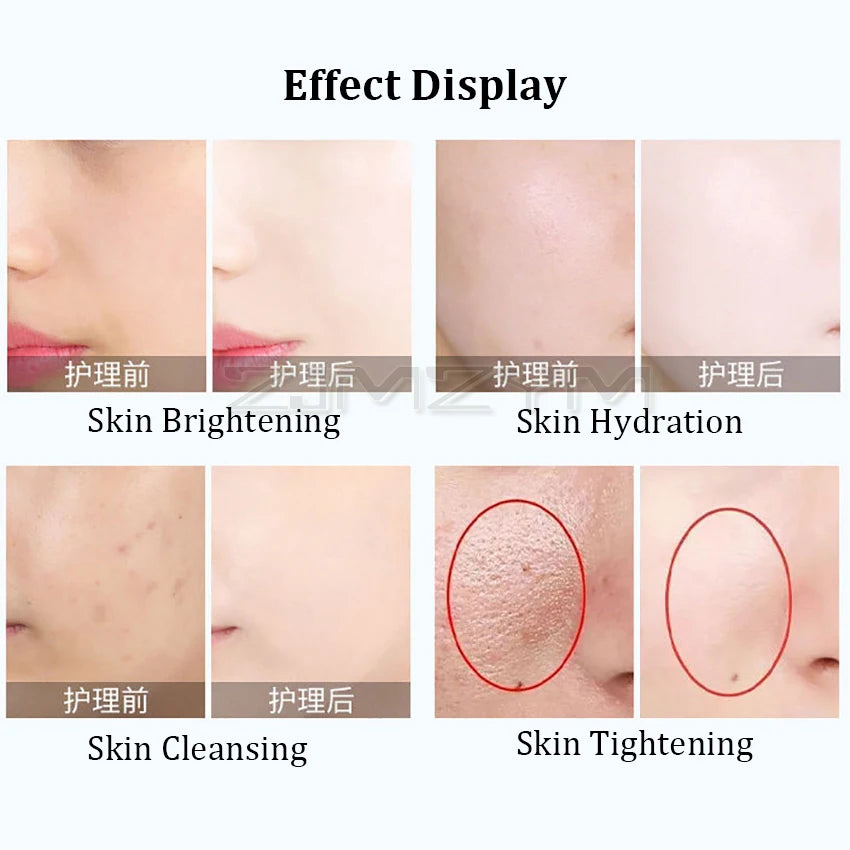 2025 Facial Skin Lifting Machine Skin Rejuvenation Wrinkle Removal Skintightening Skin Care Machine Facial Massager