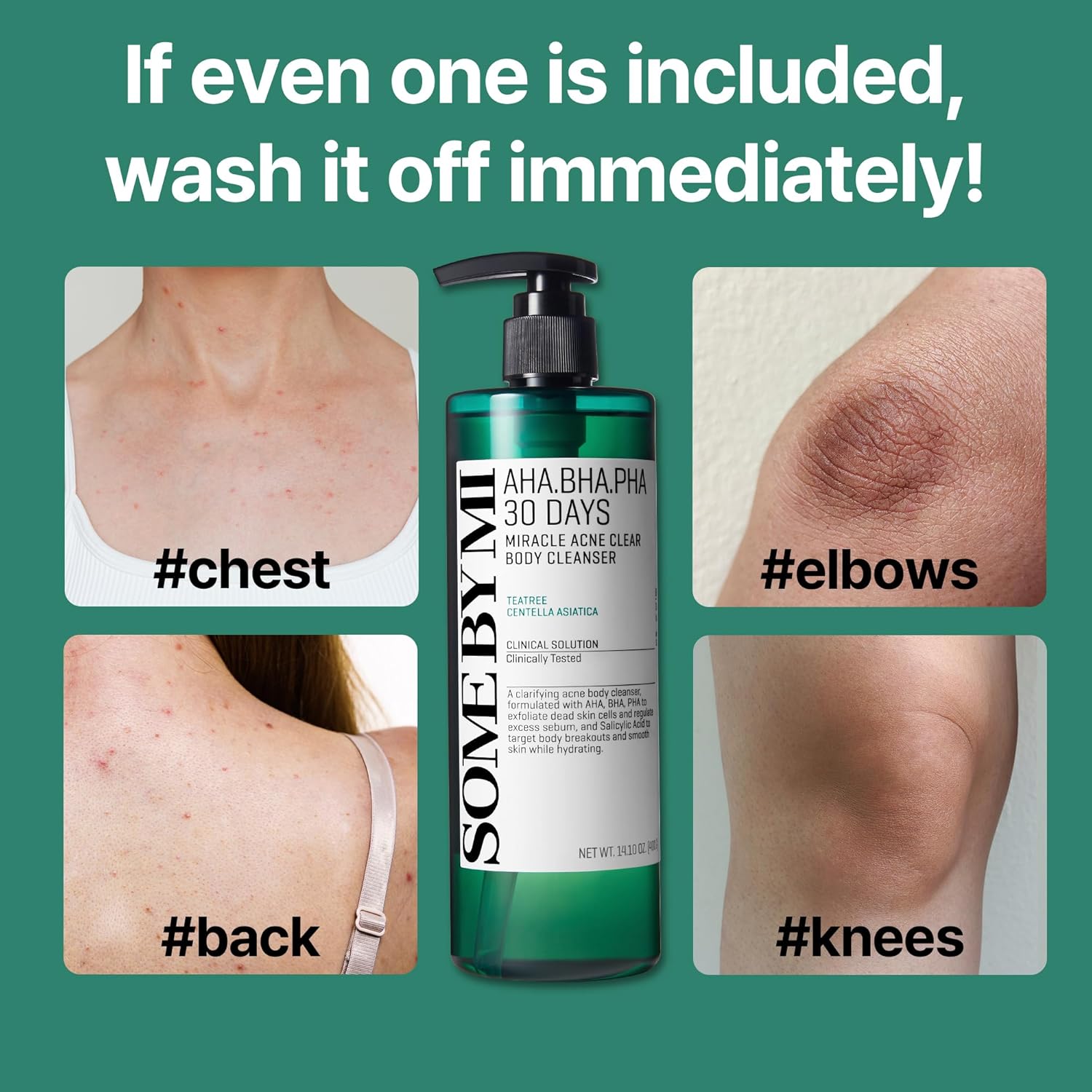 AHA BHA PHA Acne Body Wash  Deep Cleansing & Exfoliating